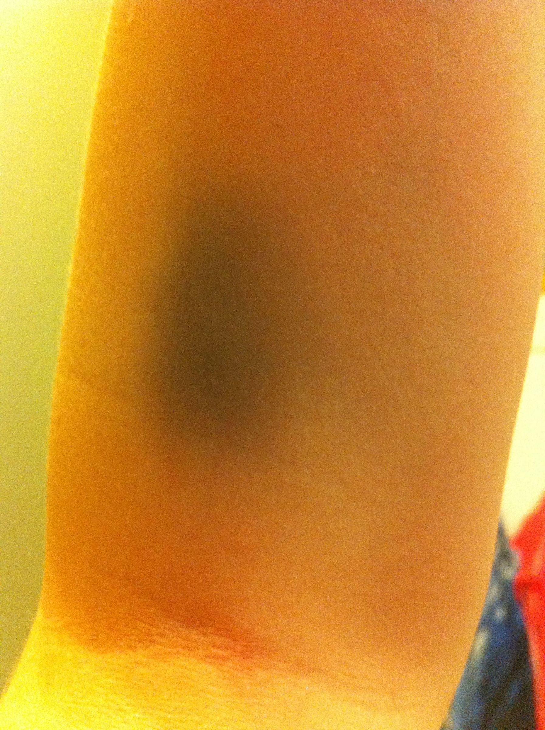 How To Create A Fake Bruise