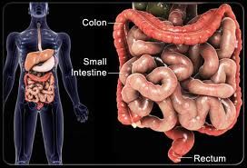 IBD : The Cure For Crohns and Ulcerative Colitis