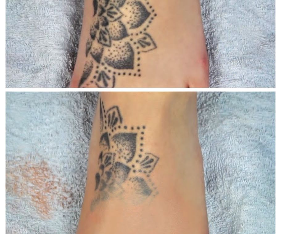 How to Cover Up a Tattoo With Drugstore Makeup