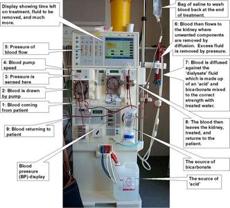 How to String a Hemodialysis Machine - Instructables