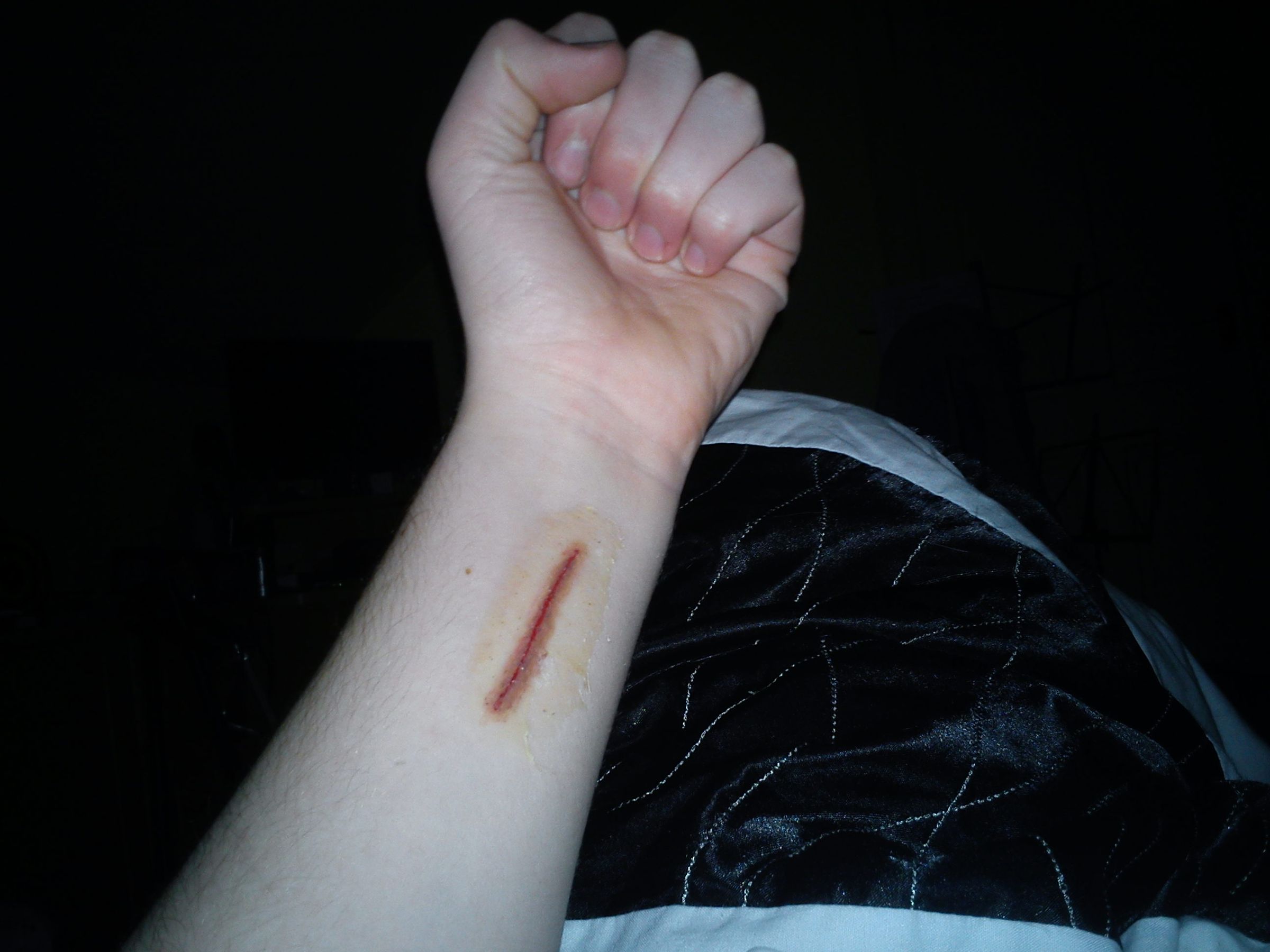 How to Make Latex Scars