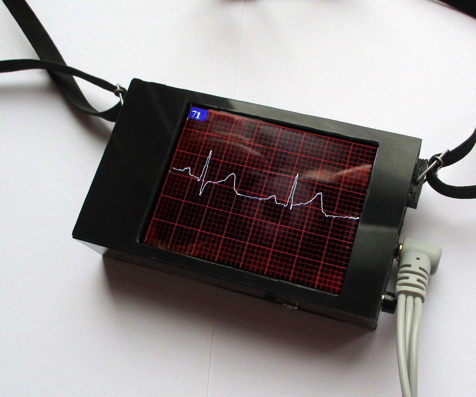 ECG Display With Arduino : 13 Steps (with Pictures) - Instructables
