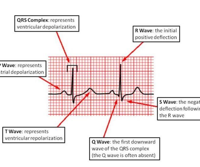 ECG Circuit (PSpice, LabVIEW, Breadboard)