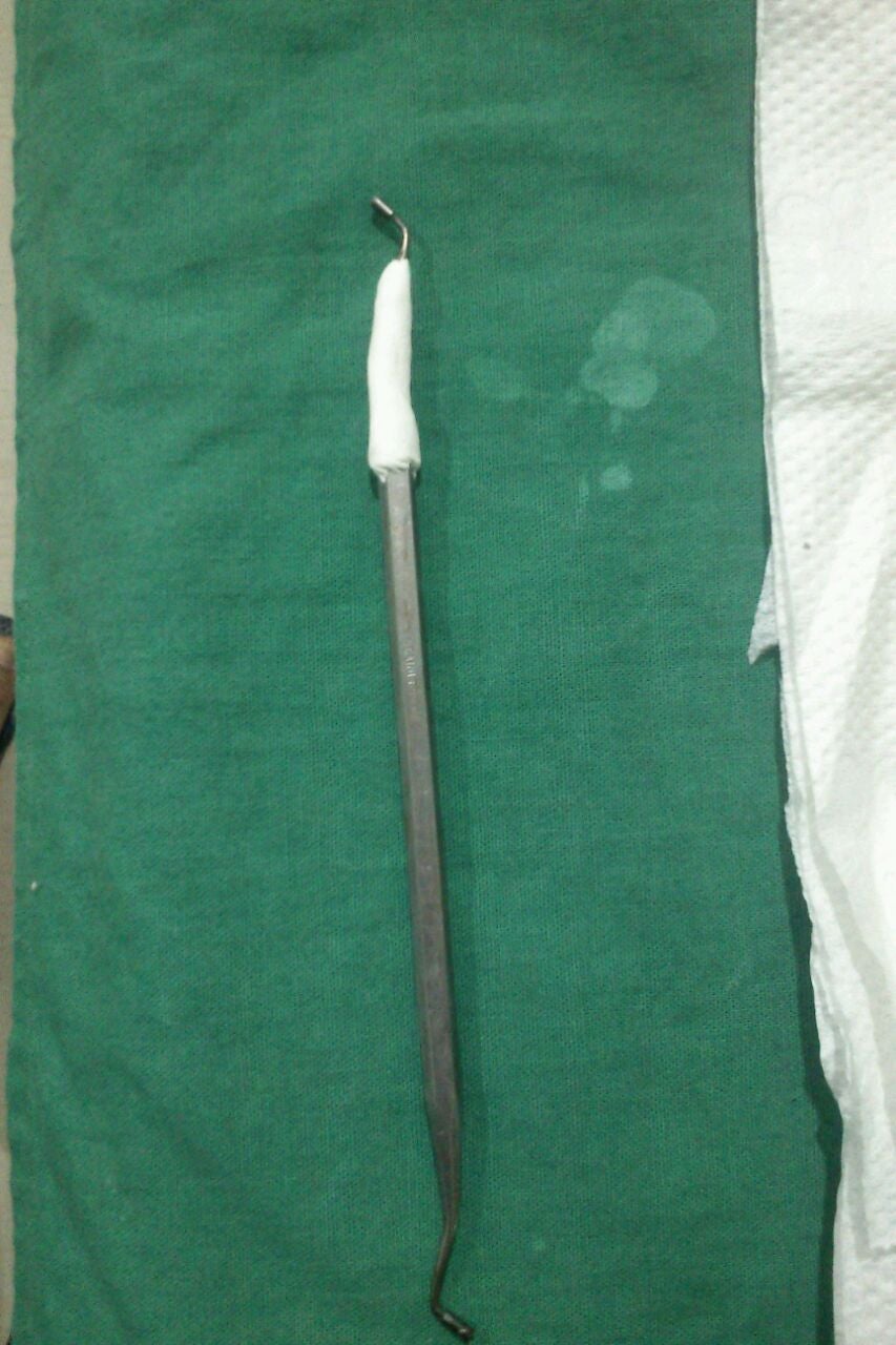 Apply Sugru to Identified Problem Areas