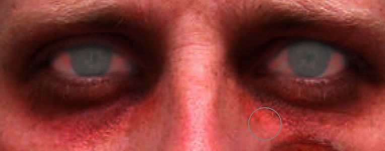 Step Ten: Vein Those Eyes.