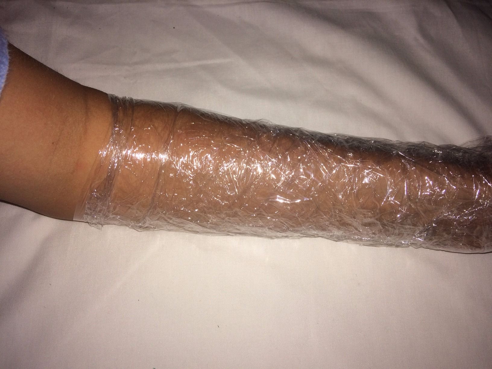 DIY Wound Healing Limb Models 7 Steps Instructables