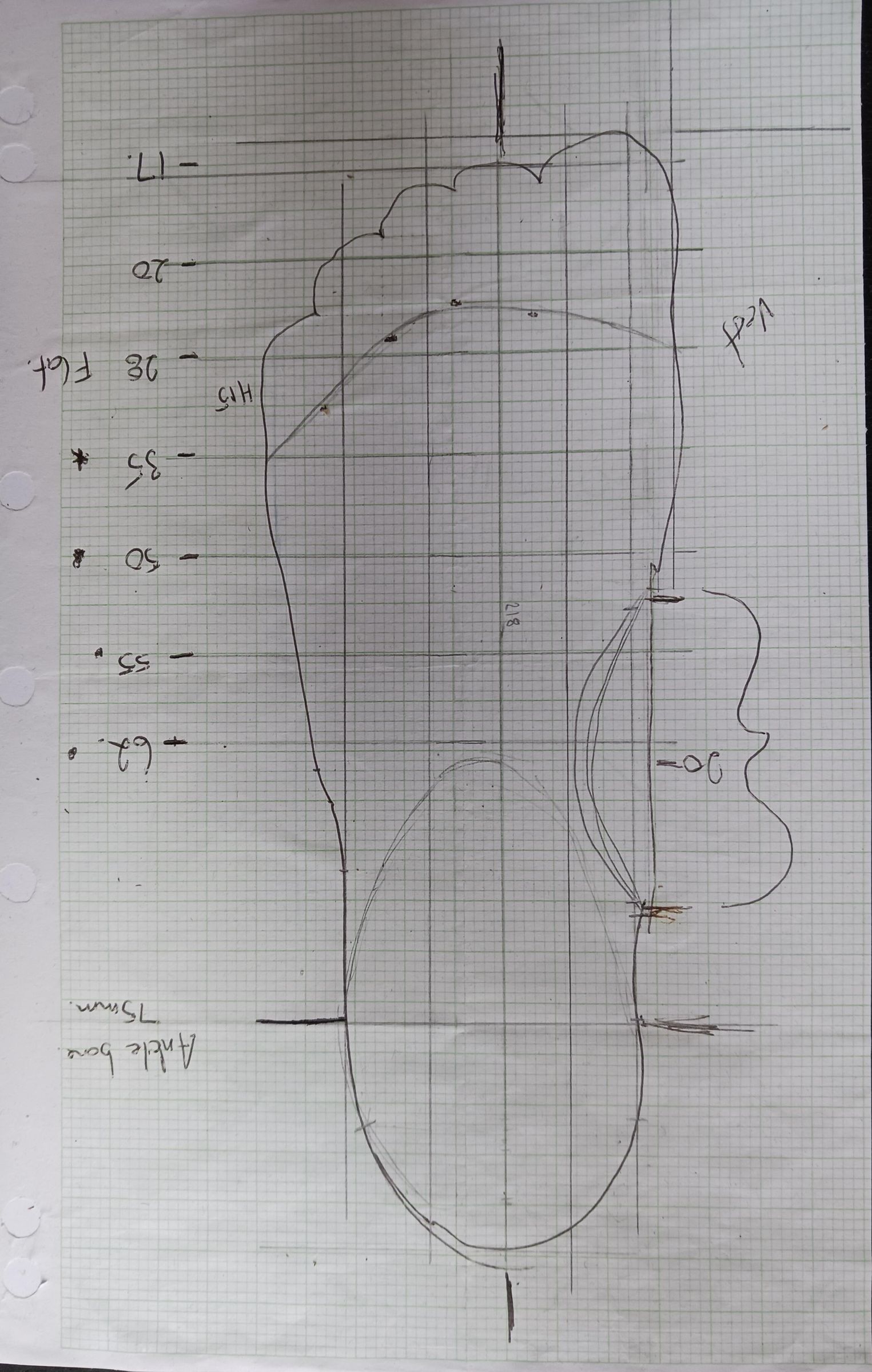 3D Printed Prosthetic Foot : 23 Steps (with Pictures) - Instructables