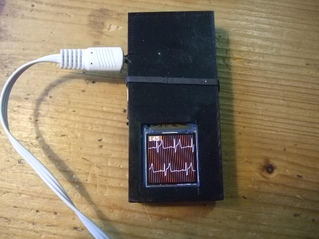 ECG With Display and SD-Card