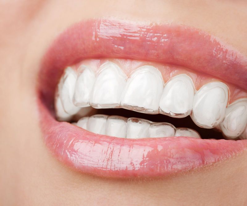 The Magic of Orthodontics.