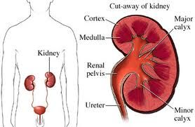 Chronic Renal Failure Cause and Treatment