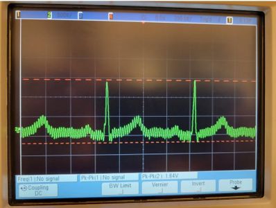 Breadboard ECG