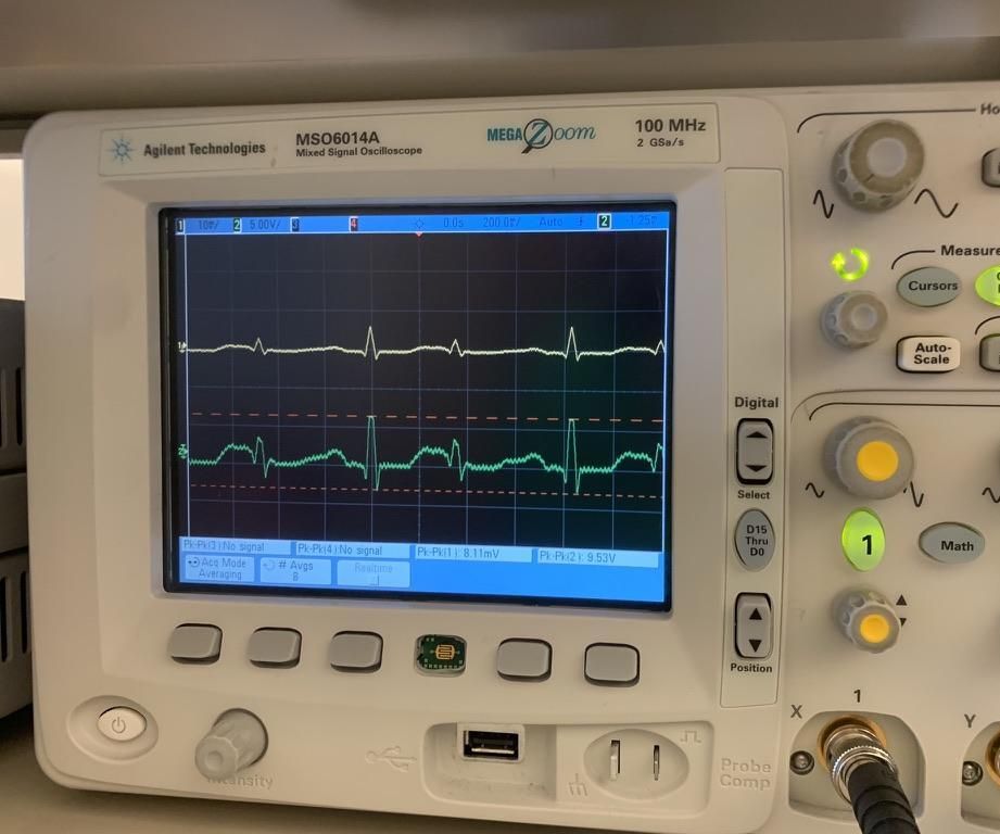 ECG Amplifier