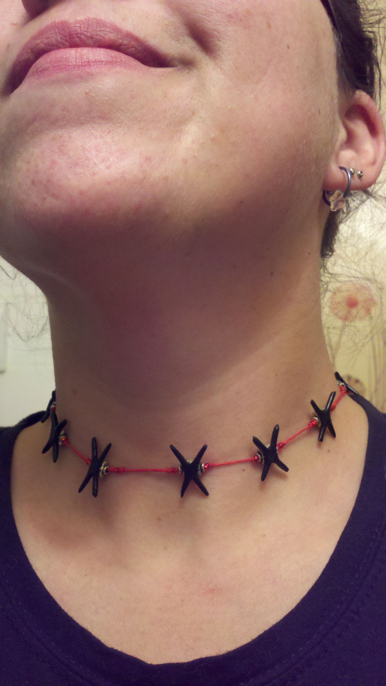 Vampire Bite Necklace