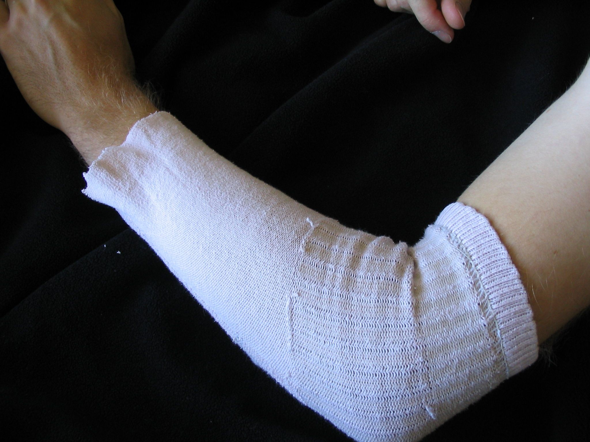 How To Bandage An Arm Nonfictioness atelieryuwa.ciao.jp