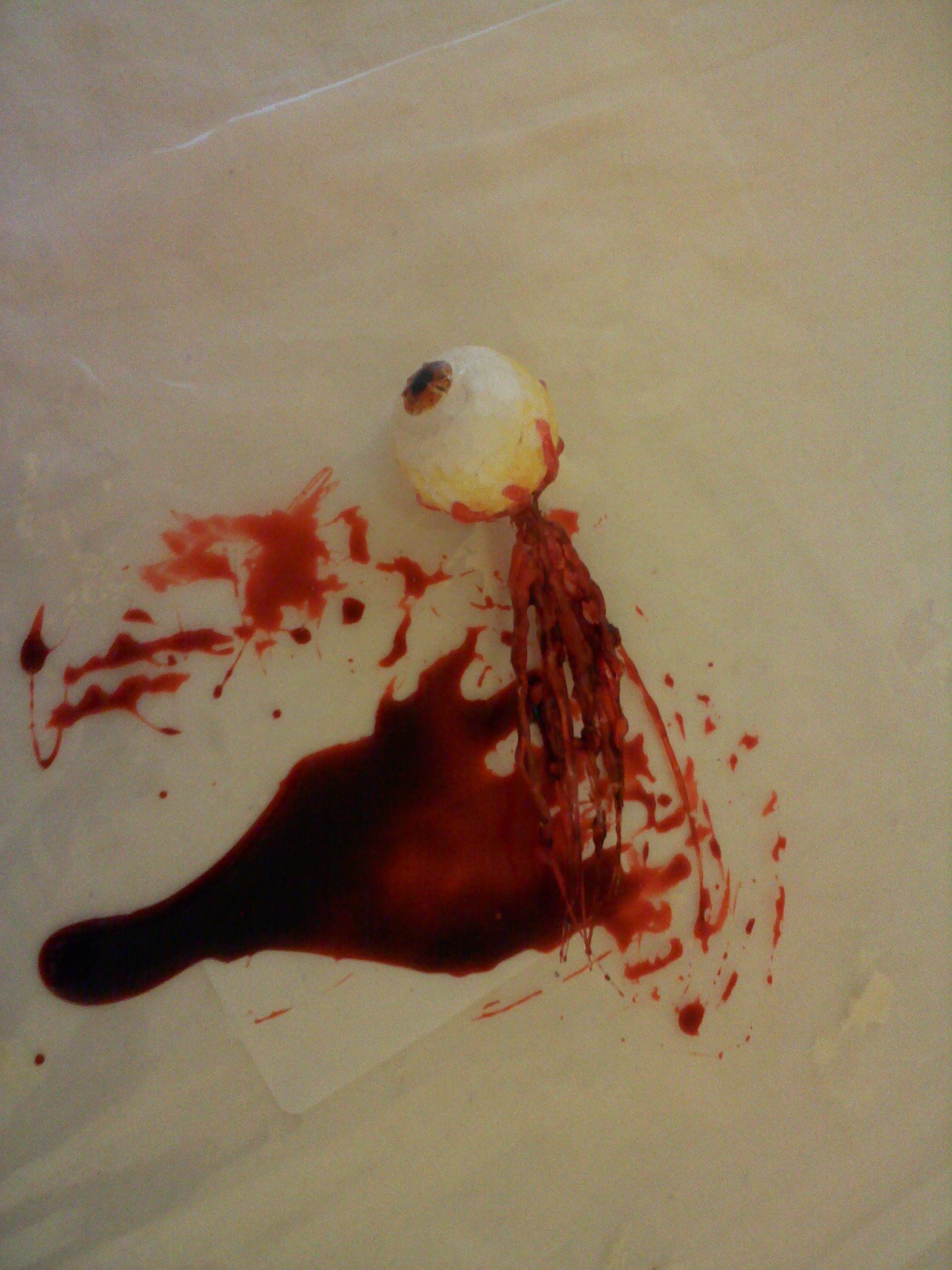 Bloody Eye Ball