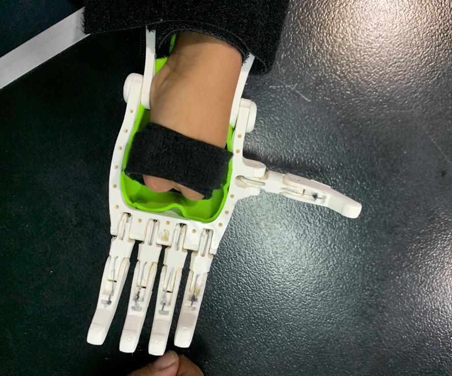 3D Print Prosthetic Hands in the Classroom.