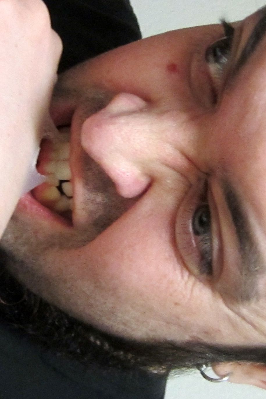 Skin Eating Prank