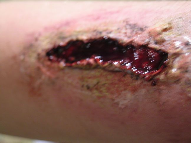 Theater Effects: Lacerations