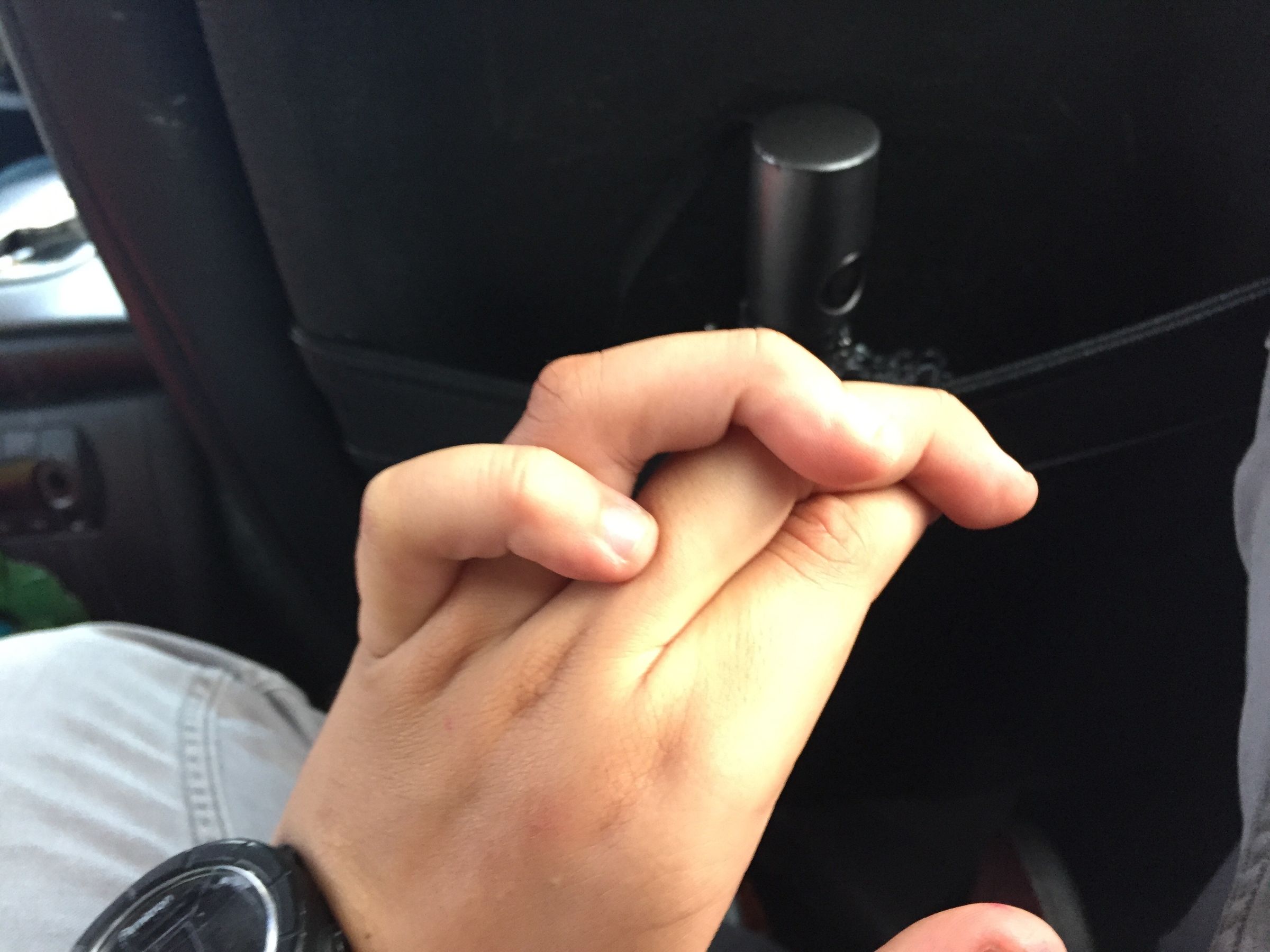 How to Make It Look Like You Have Retarded Hands