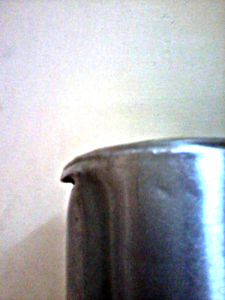 Dent Analysis