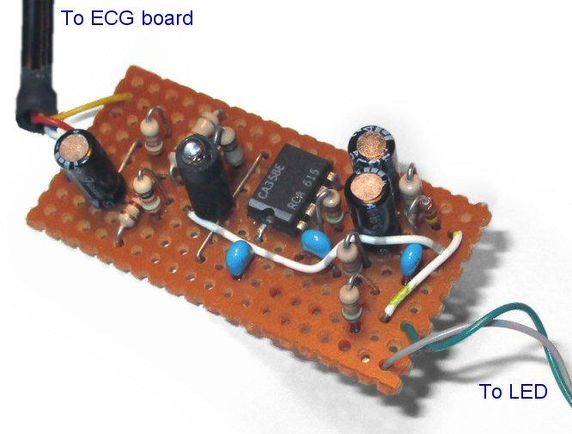 ECG With PPG Using Arduino : 9 Steps (with Pictures) - Instructables