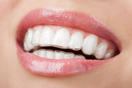 The Magic of Orthodontics.