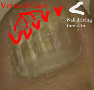  Saw Nail Vertically