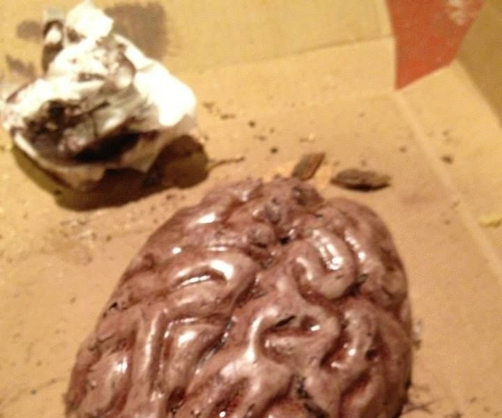 An A. B. Normal Brain