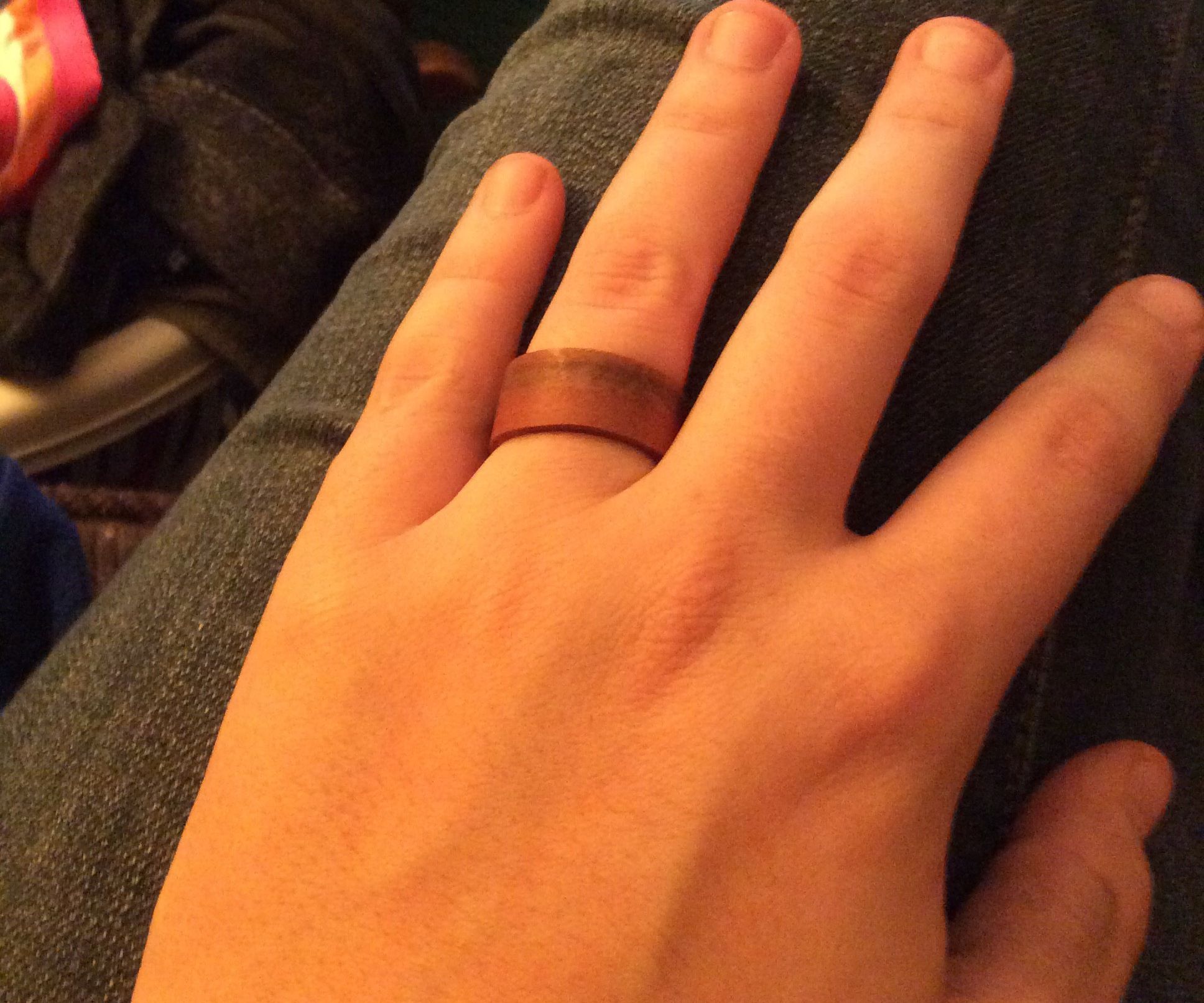 Veneer Ring 