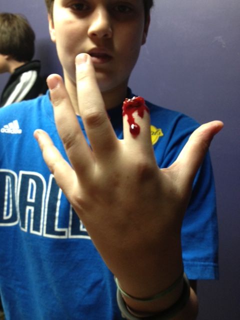 Chopped Off Finger Tutorial