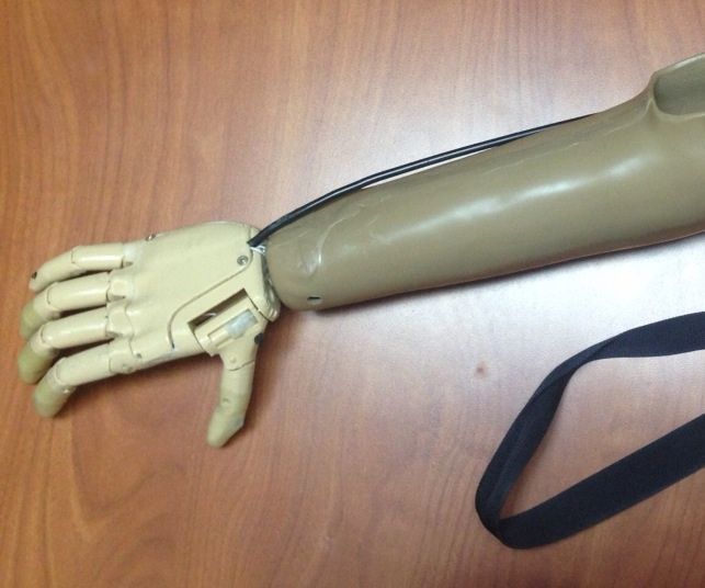 Galileo Hand - Protesis De Mano Impresa En 3D