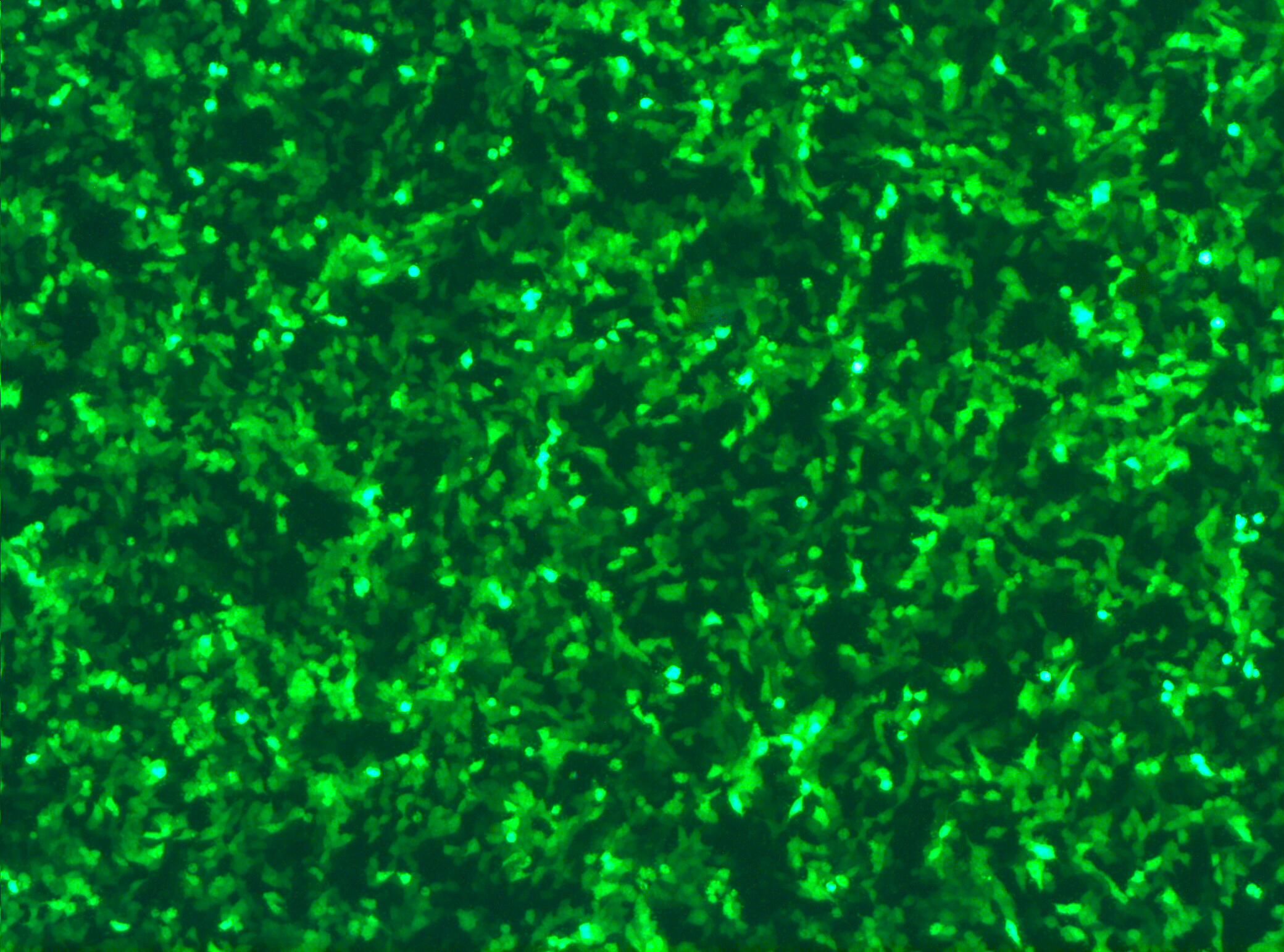 Let the Cells Exhibit Bright Green Light -- in Situ GFP Transfection
