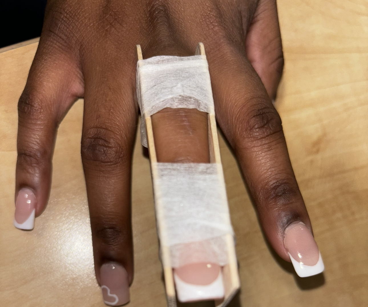 How to Splint a Finger at Home