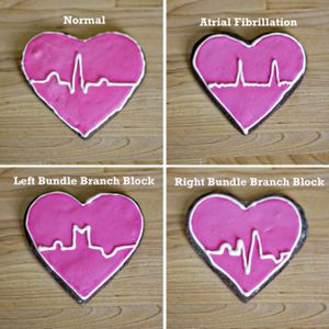 ECG Cookies
