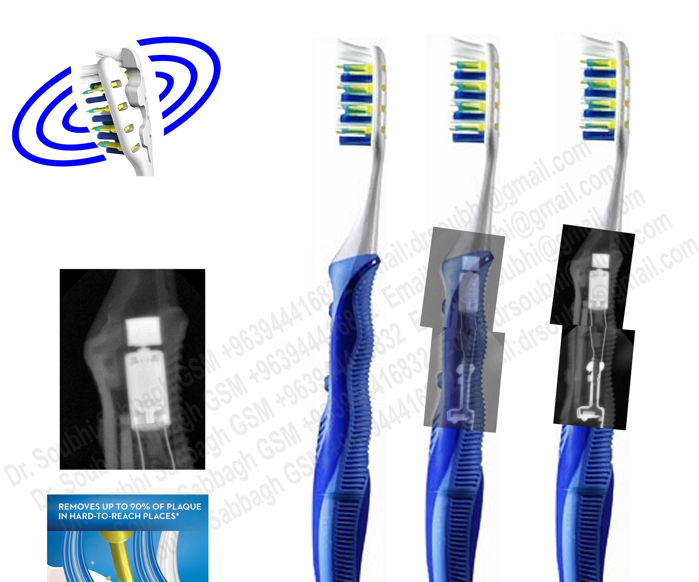 How Oral-B Pulsar Brush Works