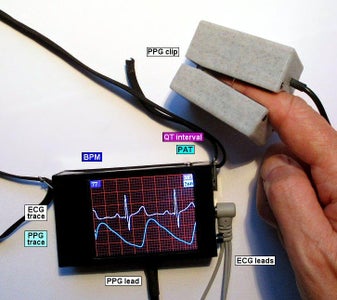 ECG With PPG Using Arduino : 9 Steps (with Pictures) - Instructables