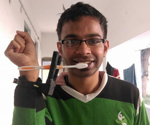 Affordable Multipurpose Prosthetic for People Without Fingers