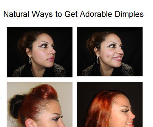 How to Get Back Dimples