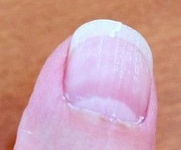 How to Repair a Cracked Fingernail