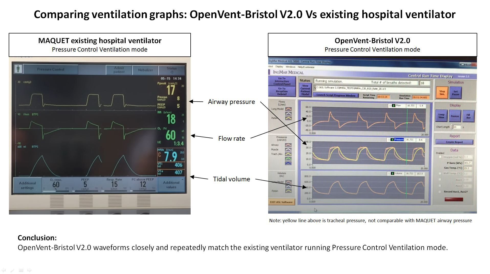 OpenVent-Bristol V2.0 COVID-19 Rapid Manufacture Ventilator BVM Ambubag ...