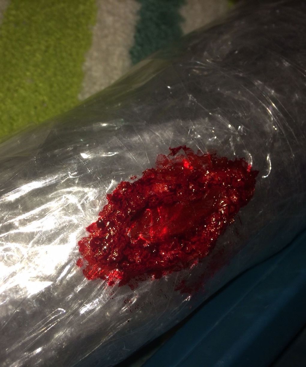 DIY Wound Healing Limb Models