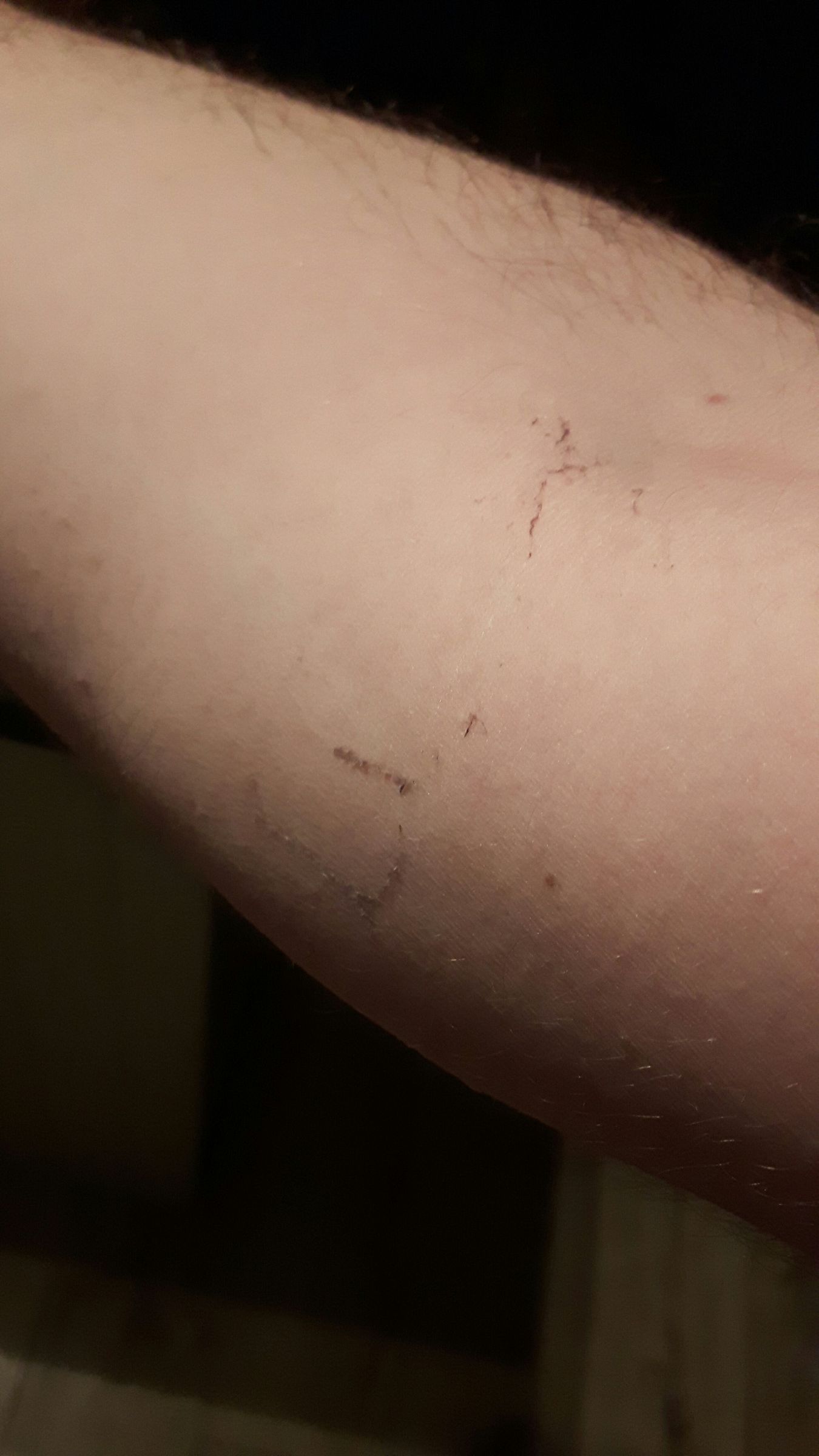 Remove Residual Adhisive