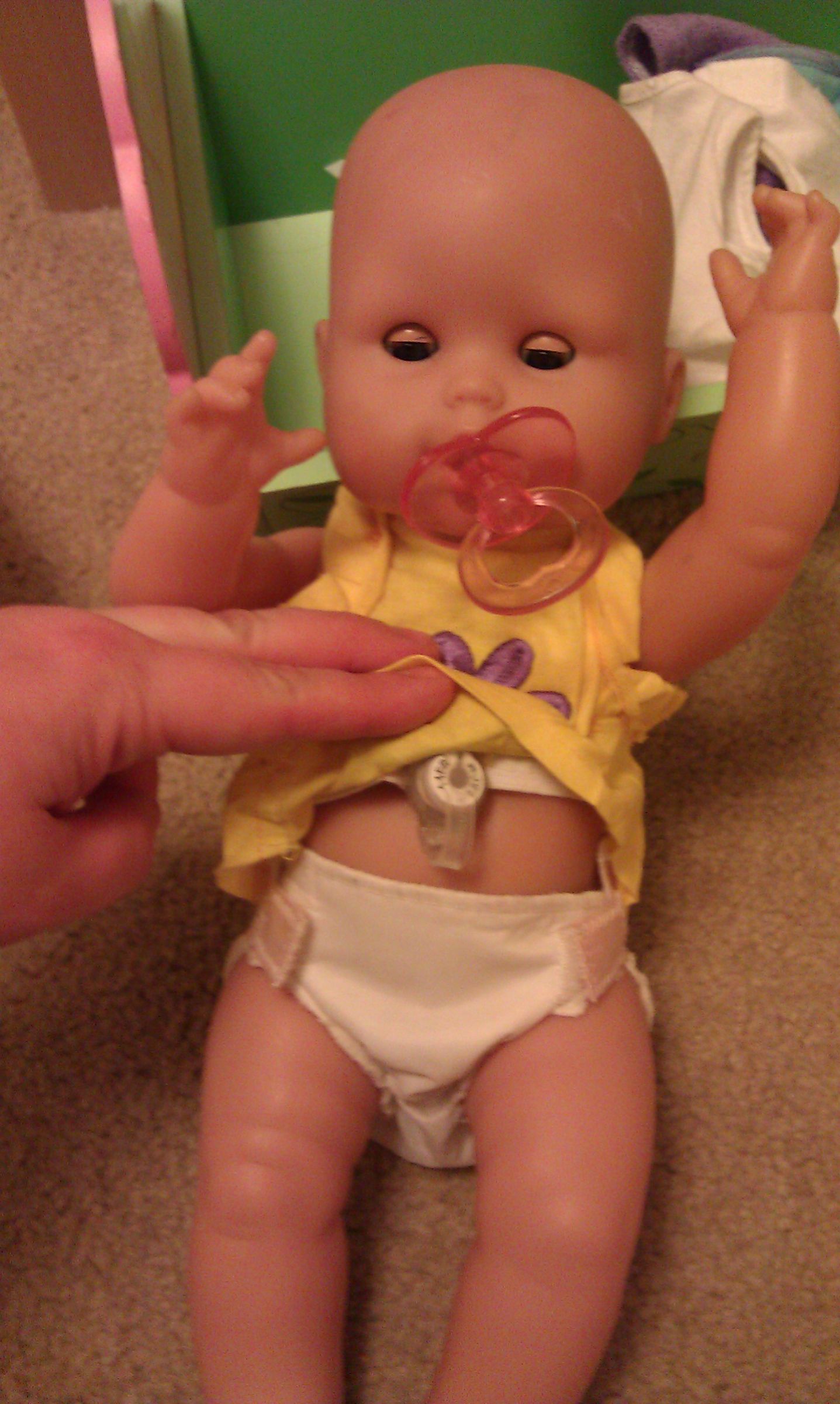 Removable Gastrostomy Button for "Play Model" Doll