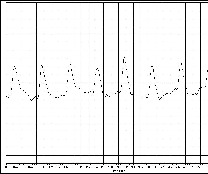 Another Heart Rate Monitor