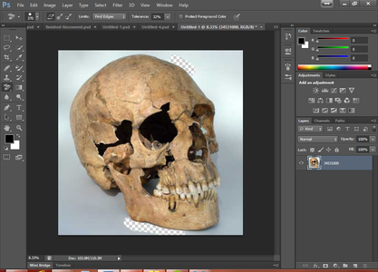 The Skull, Wound and the Spine
