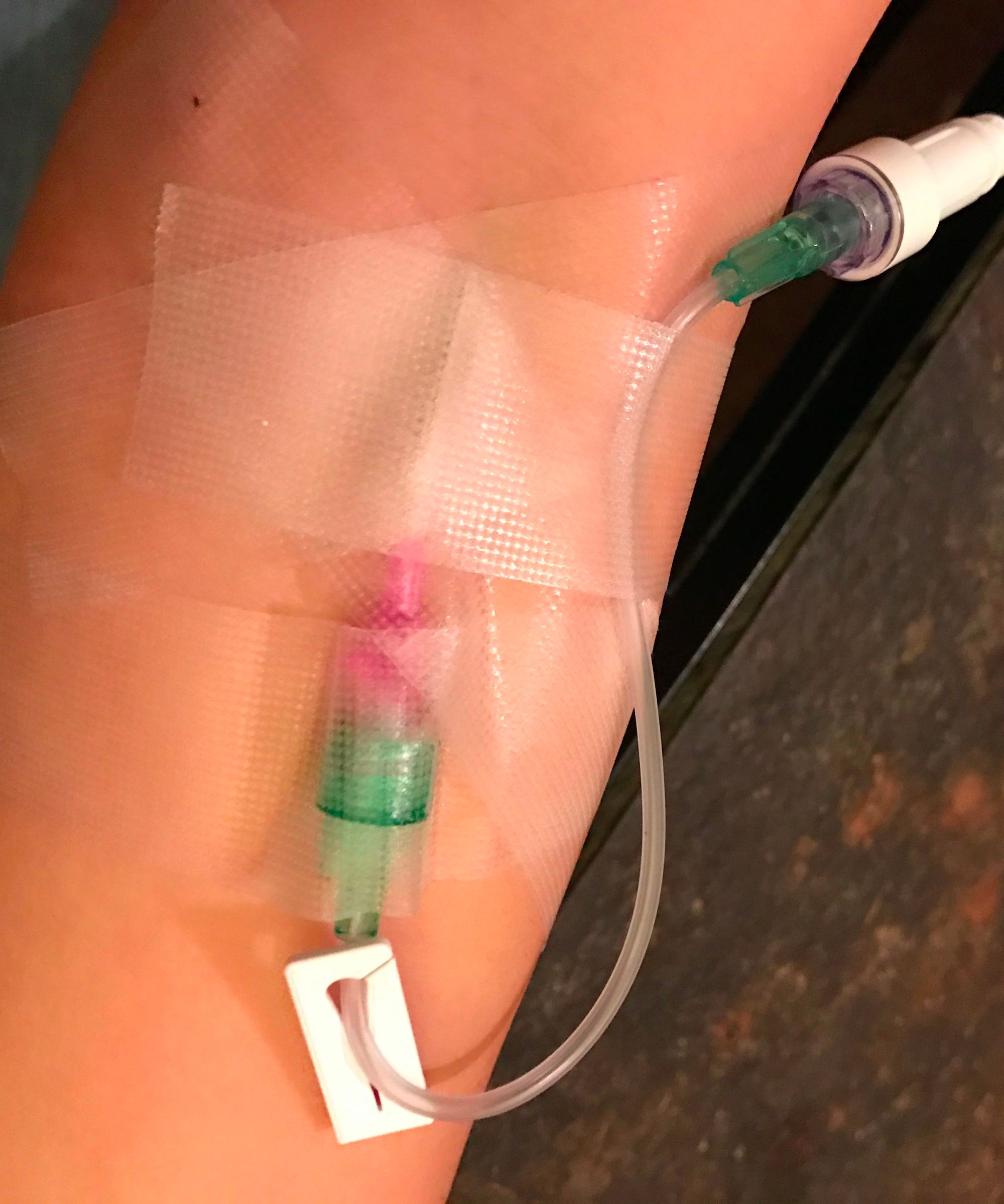 How to Insert an IV