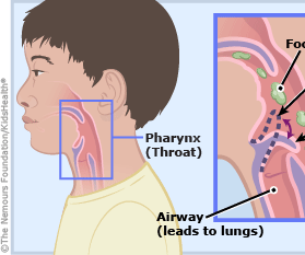 Choking Prevention for Children