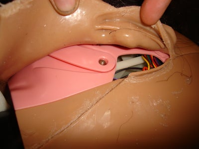 Skin Removal Continued