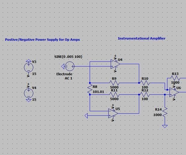 Automated ECG: Amplification and Filter Simulations Using LTspice