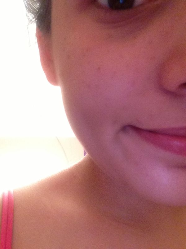 Fake Freckles